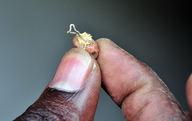 Fungus growing on a bean | Photo: N Palmer/CIAT