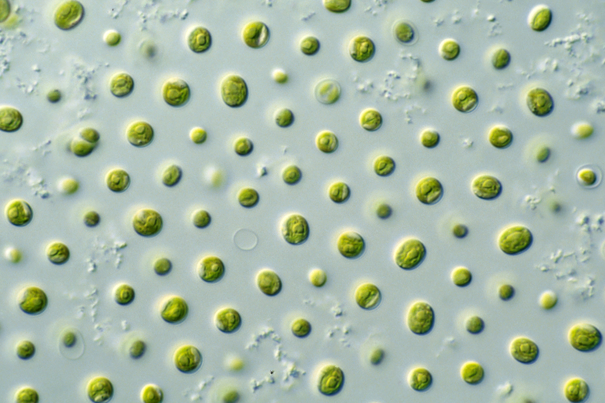 Microalgae. Photo by CSIRO on Wikimedia